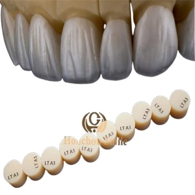 Veneer-Restaurierung aus Glaskeramik